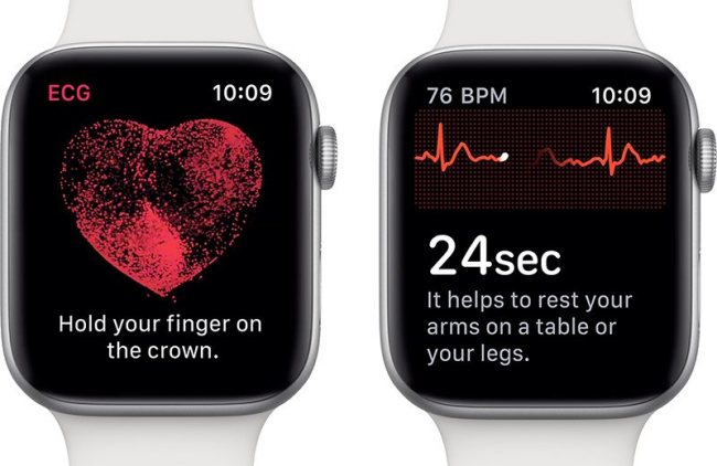 Con watchOS 5.2 Apple Watch permette di elaborare un elettrocardiogramma