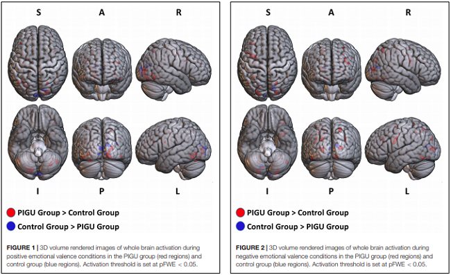 La Instagram-dipendenza è visibile a livello cerebrale secondo uno studio accademico