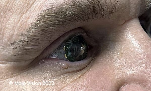 Realtà aumentata in una lente a contatto: Mojo Lens