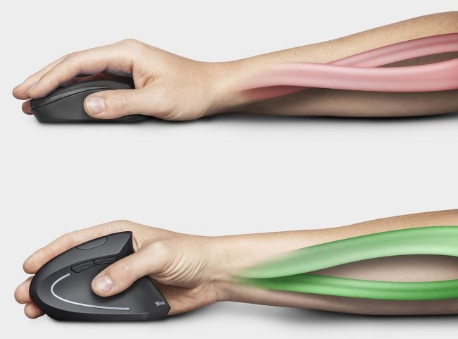 Mouse verticale, a cosa serve e come sceglierlo